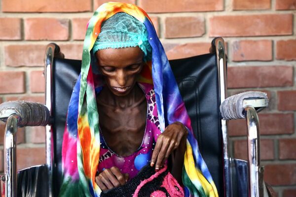 Saeeda Ahmed, de 18 anos de idade, a imagem dramática da fome no hospital da cidade portuária de Hodeidah, Iêmen. Segundo a UNICEF, no Iêmen três milhões de pessoas precisam de alimentos e meio milhão de crianças sofrem de desnutrição - Sputnik Brasil