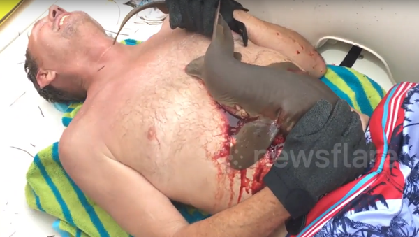 Tubarão merdeu homem na Flórida - Sputnik Brasil